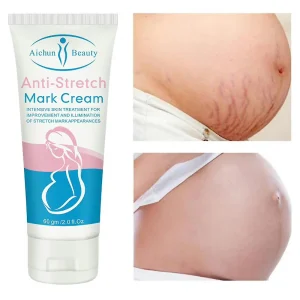 aichun beauty anti stretch mark cream 60g
